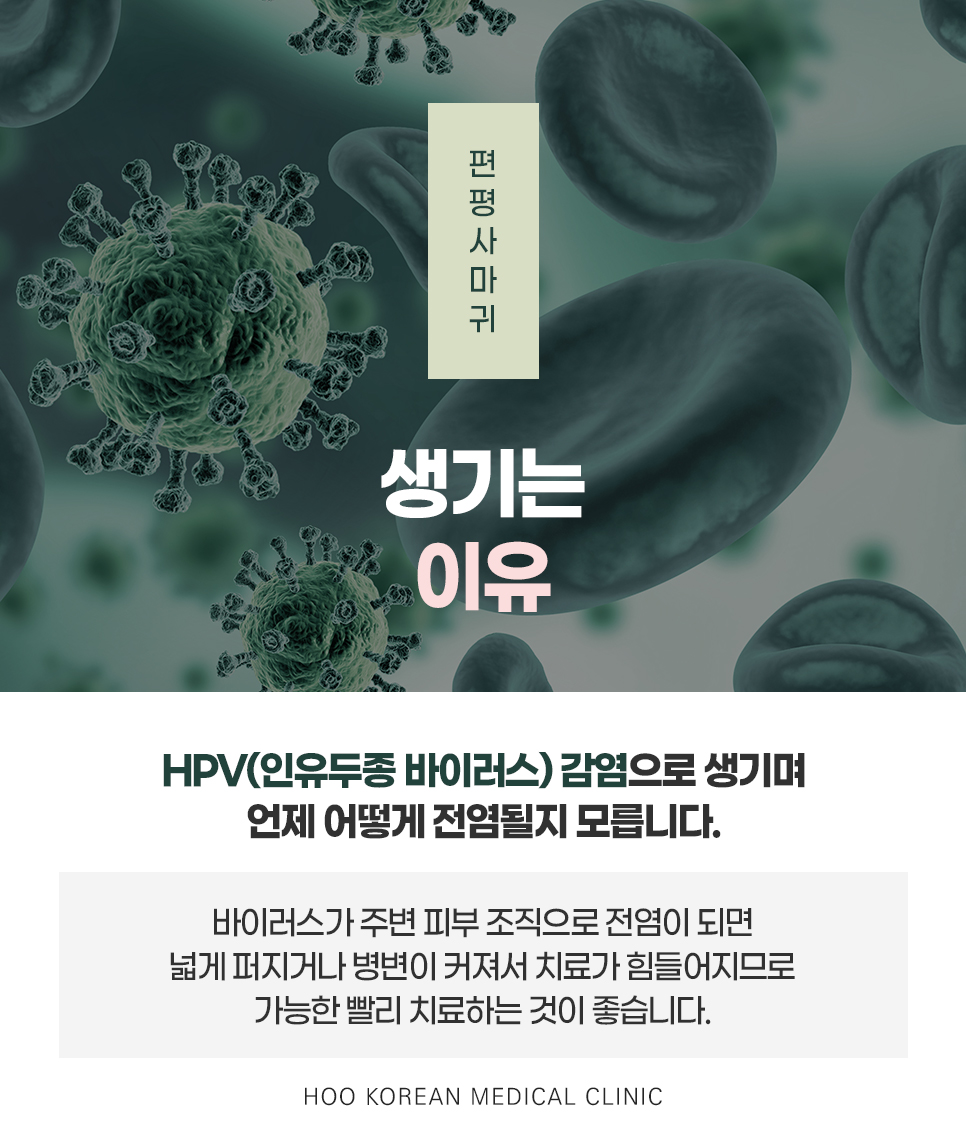 편평사마귀 원인 HPV 인유두종바이러스