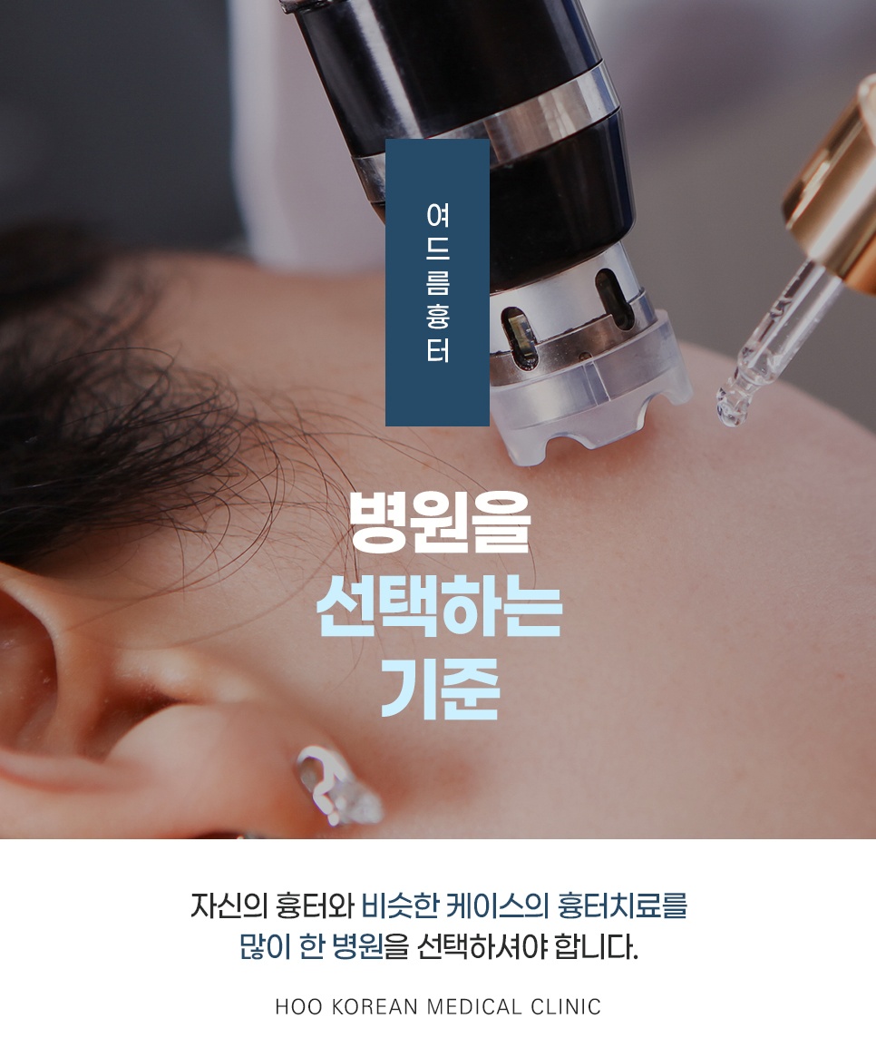여드름 흉터 치료 장비로 시술받는 모습, 병원 선택 기준 안내