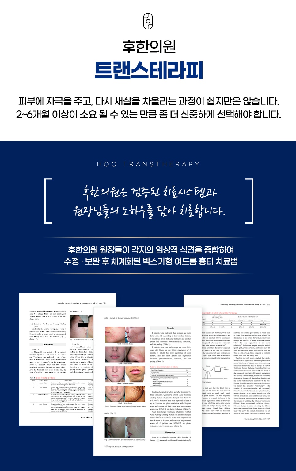 후한의원 트랜스테라피 소개 및 박스카형 여드름 흉터 치료 논문 자료