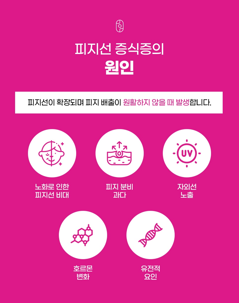 피지선 증식증 발생 원인 5가지 - 노화, 피지 과다, 자외선, 호르몬, 유전