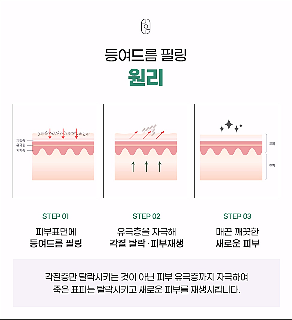 춘천등여드름 후윤약초필링 원리, 유극층 자극과 피부 재생 3단계 과정