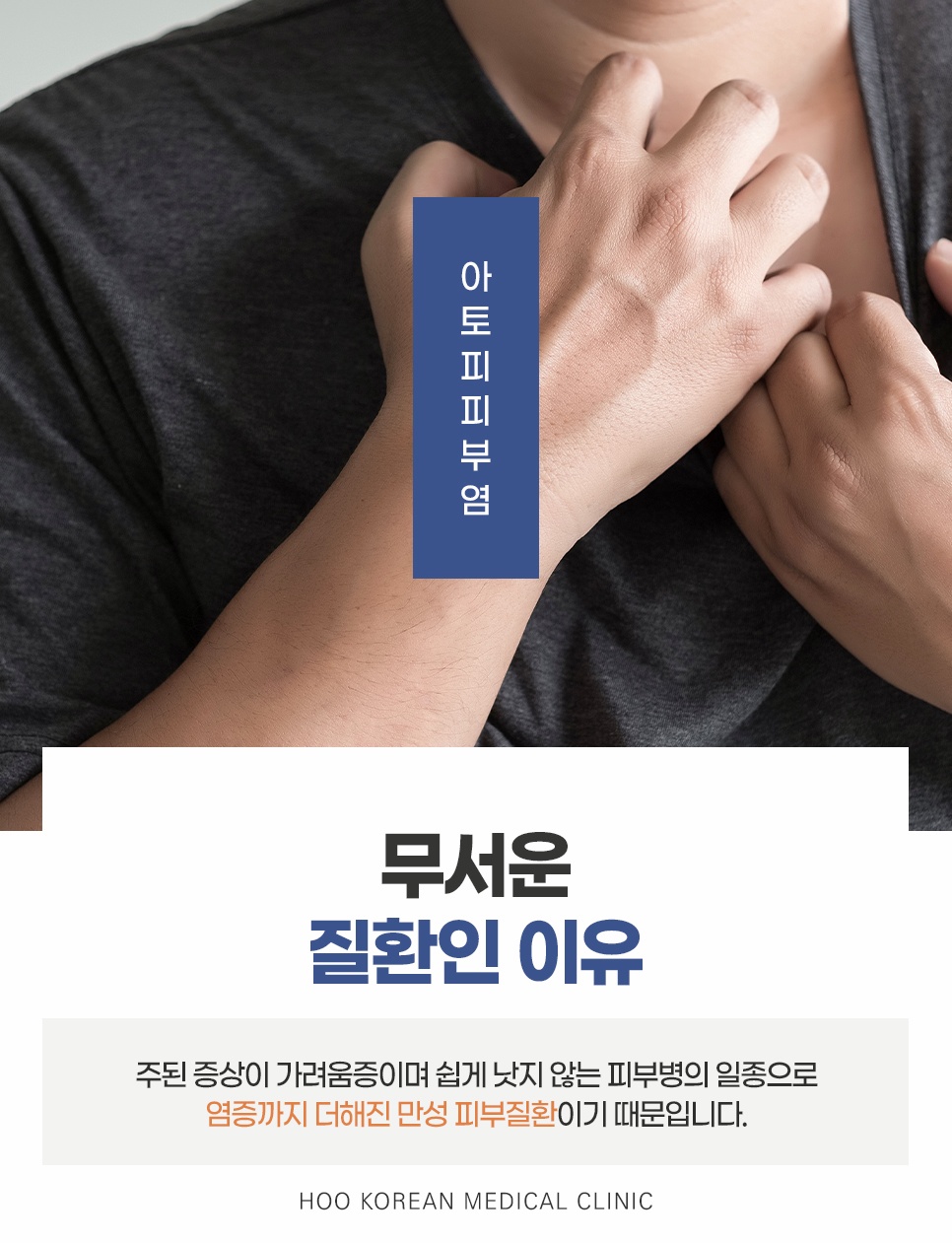 춘천아토피 피부염 무서운 이유 만성 피부질환 가려움증 증상