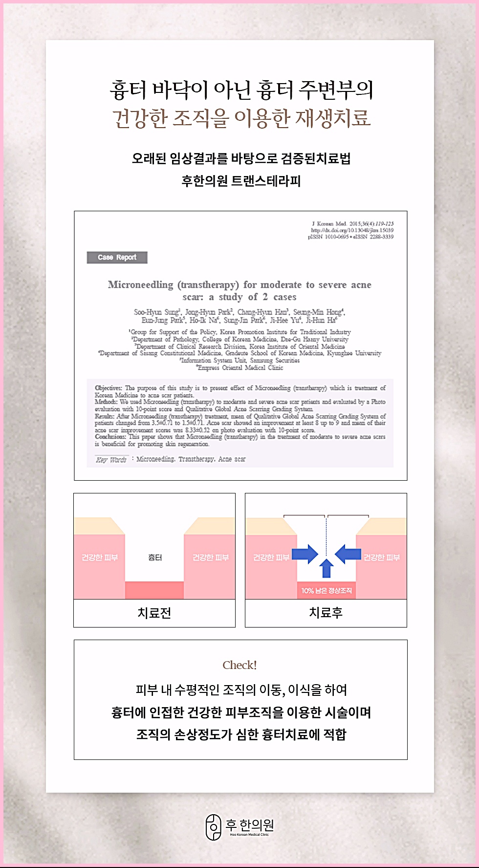 춘천새살침 트랜스테라피의 임상적 근거가 되는 학술 사례 연구 및 치료 전후 조직 구조