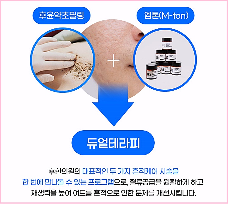 후윤약초필링과 엠톤을 결합한 듀얼테라피 구성 설명