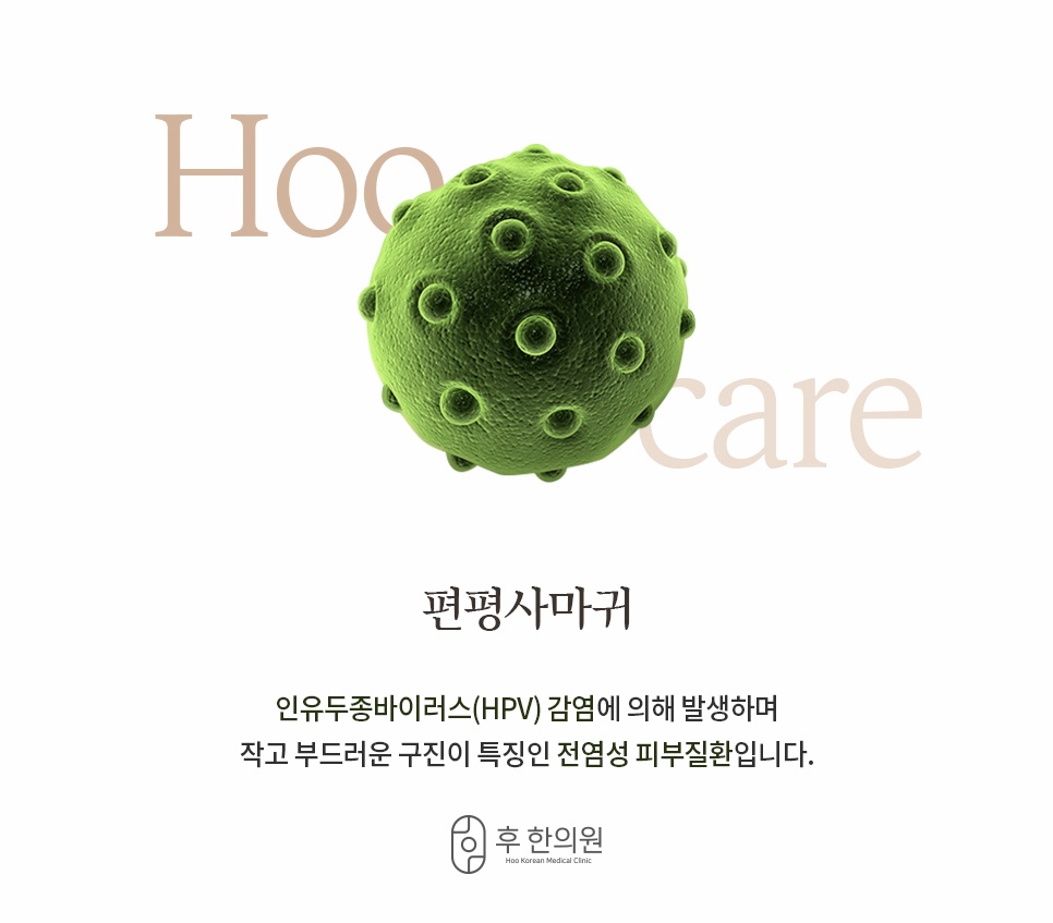 인유두종바이러스(HPV) 감염으로 발생하는 전염성 편평사마귀 특징