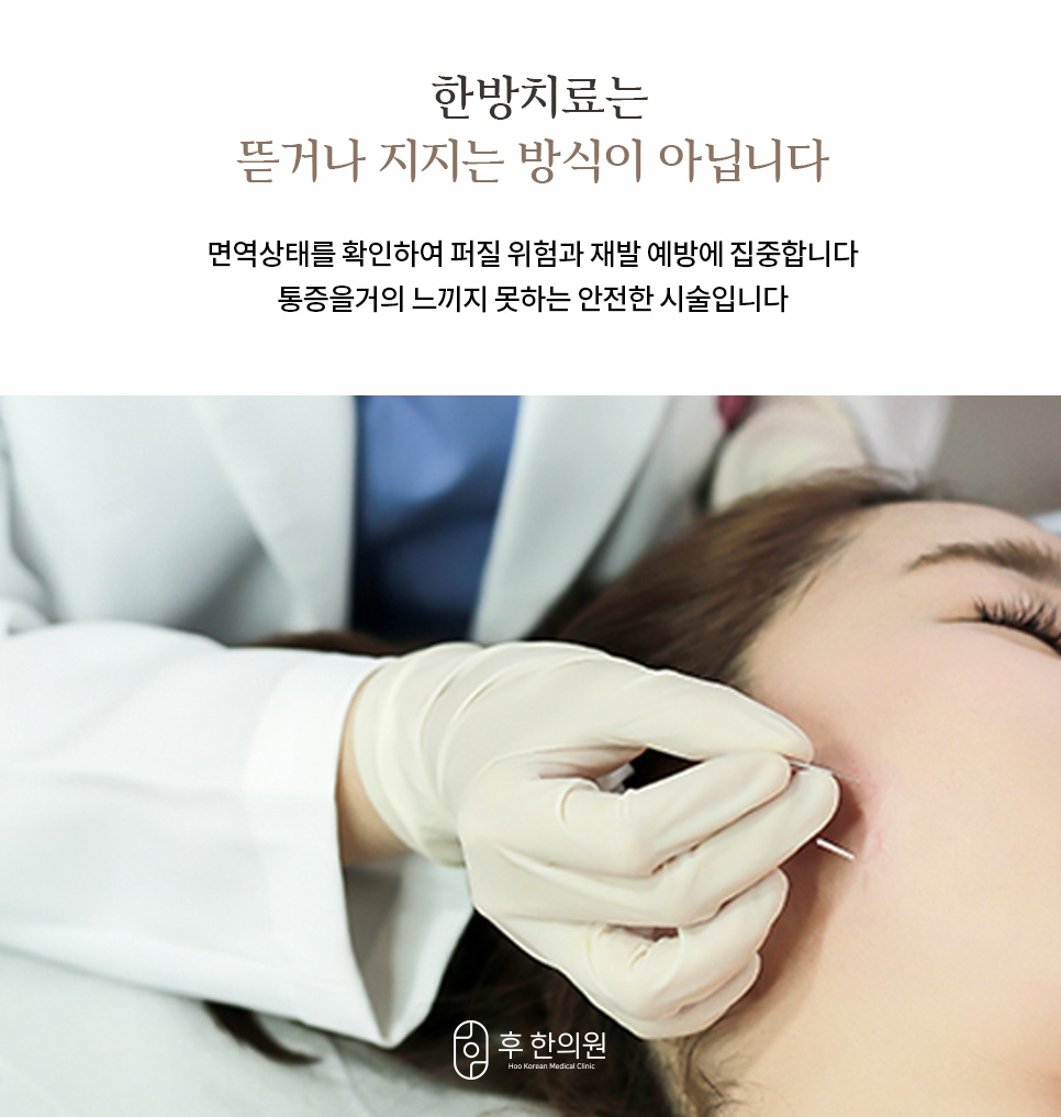 재발 예방과 면역력 강화를 돕는 후한의원 침 기반 사마귀 케어