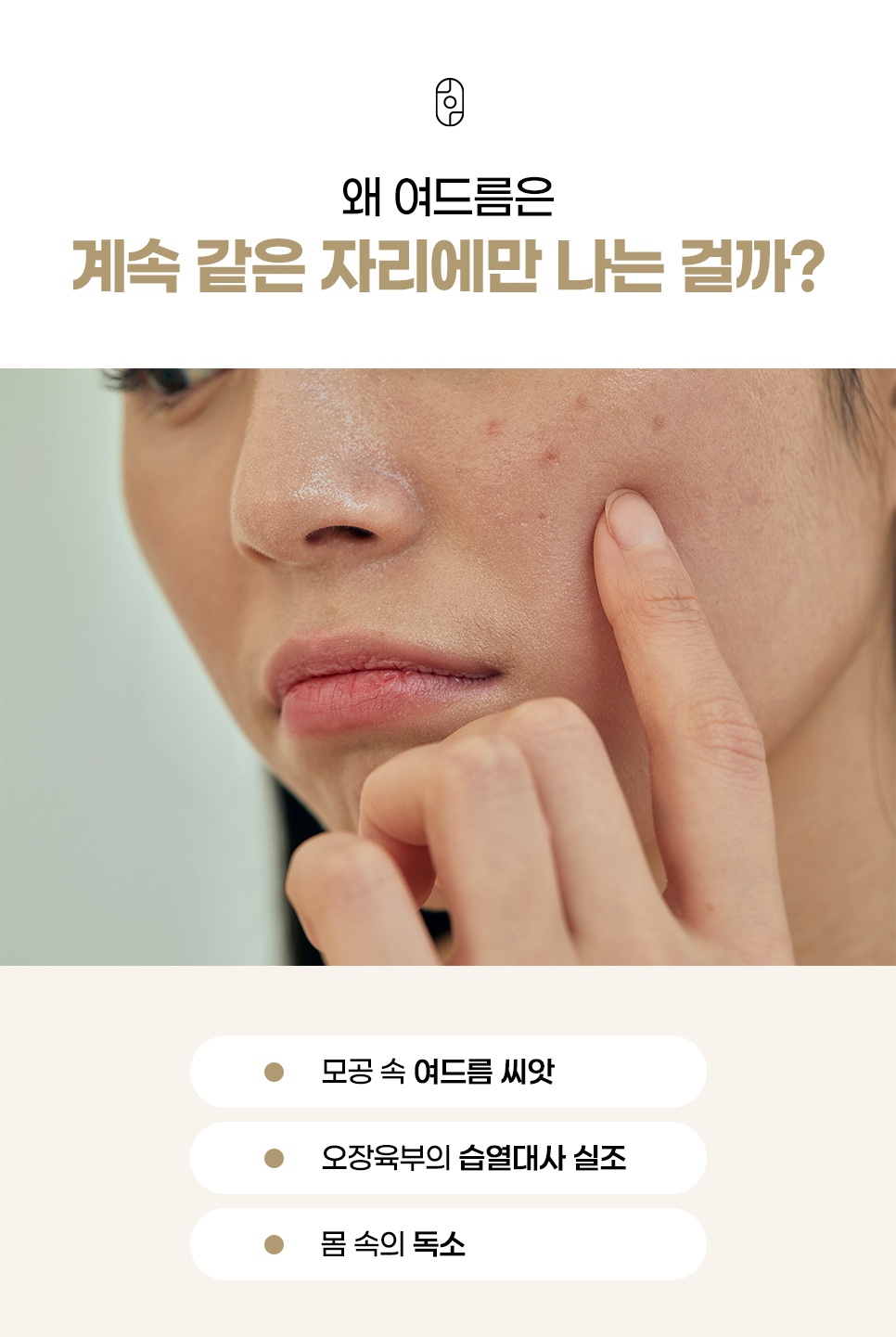 모공 속 여드름 씨앗과 오장육부 습열대사, 몸속 독소를 원인으로 짚은 반복 여드름 설명
