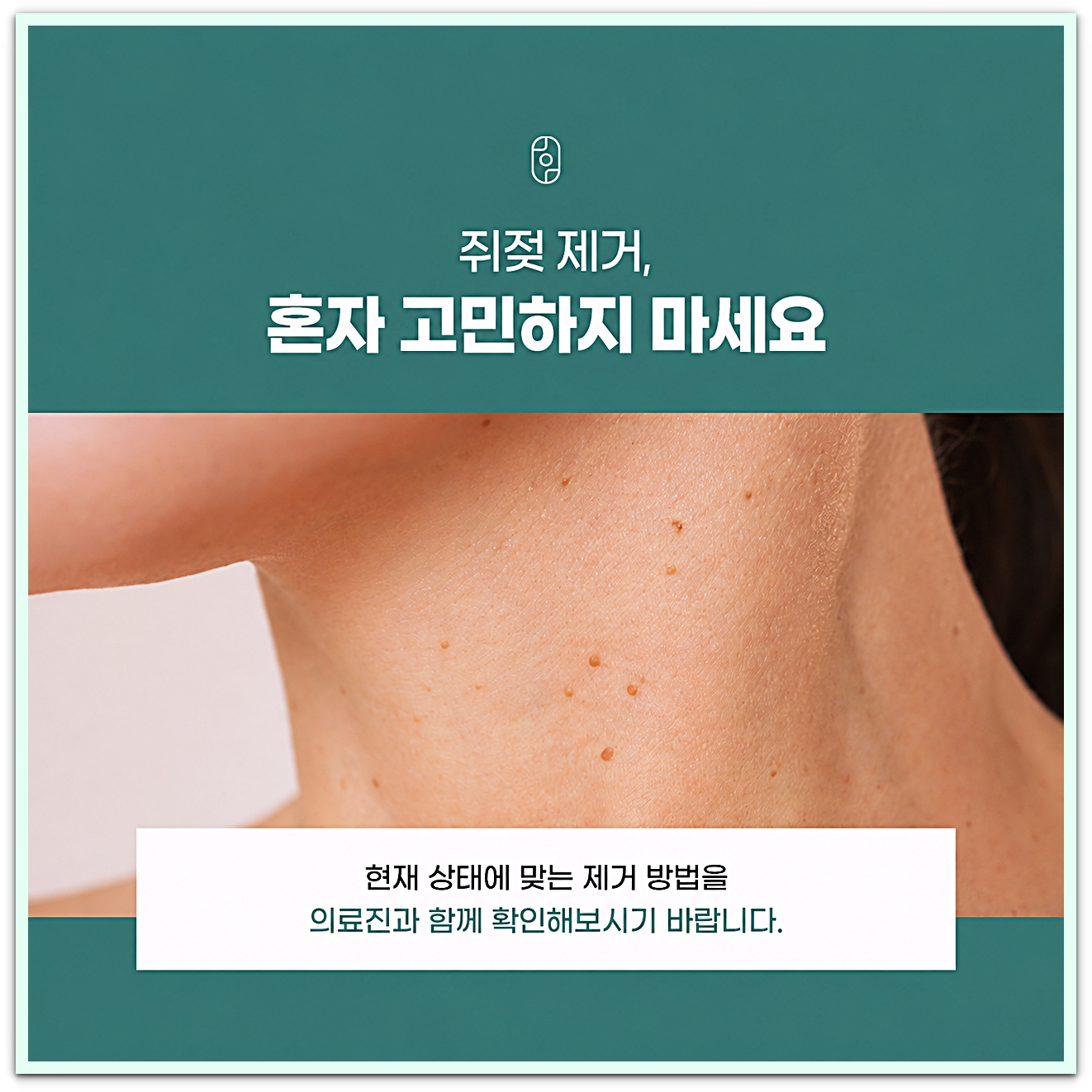 춘천쥐젖제거 목 주변 피부에 생긴 쥐젖과 상태에 맞는 제거 방법 안내