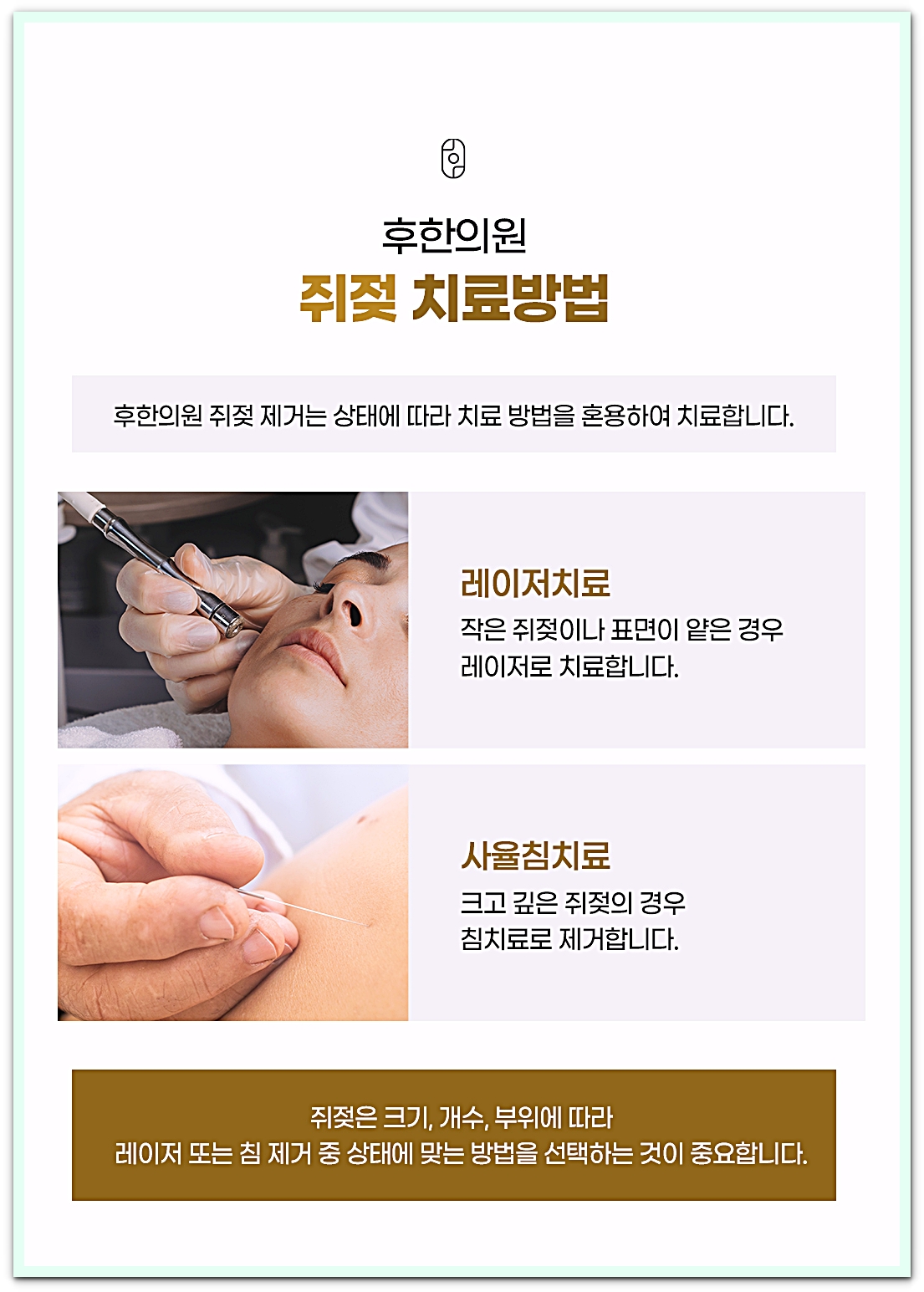 후한의원 쥐젖 치료방법으로 레이저치료와 사율침치료를 소개