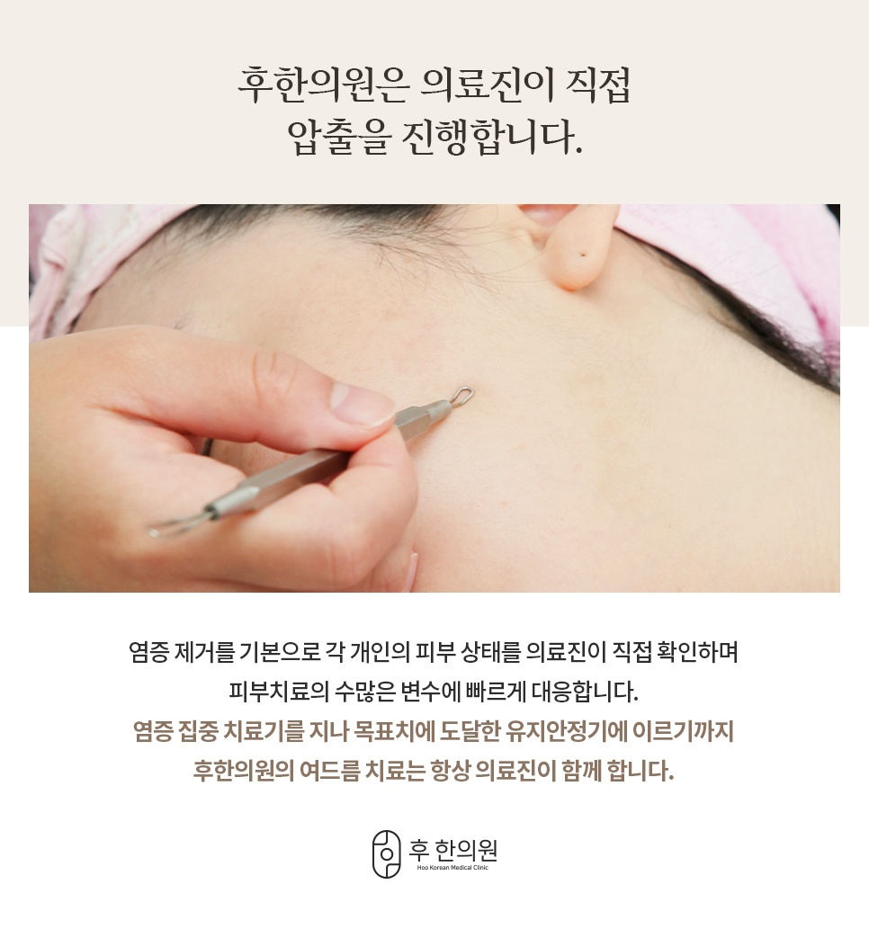 압출기를 든 손으로 의료진이 직접 염증을 제거하는 여드름 압출 장면