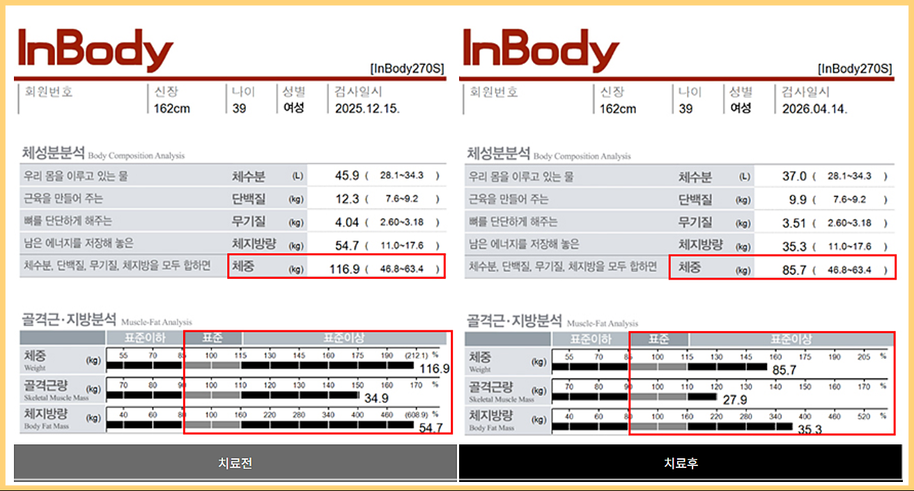 인바디 전후