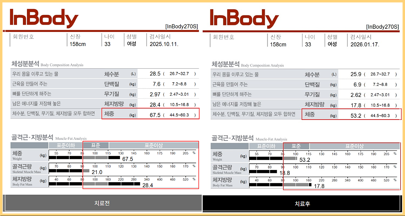 춘천다이어트한의원 한약 복용 인바디 전후