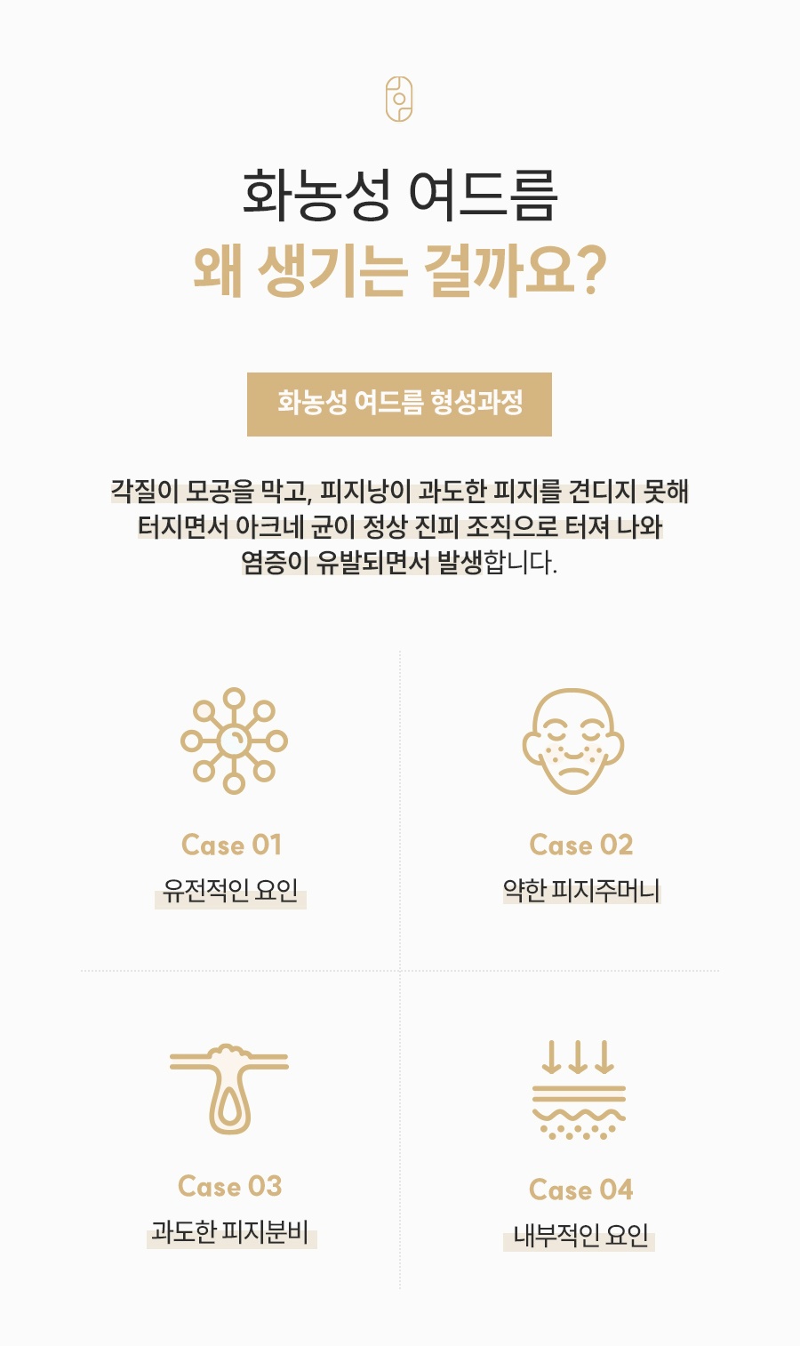 화농성 여드름 형성과정과 유전·약한 피지주머니·과도한 피지분비·내부 요인 4가지 원인