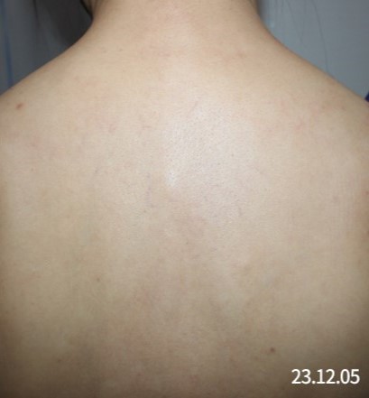 After
