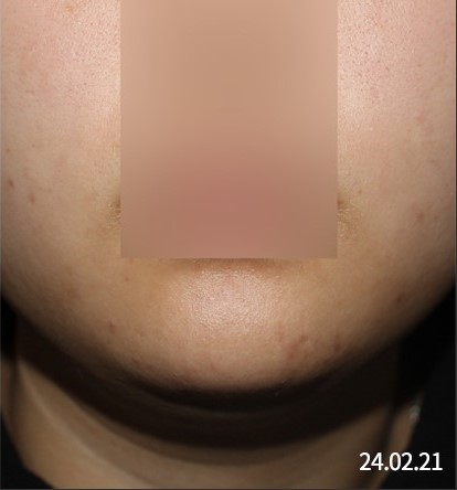 After