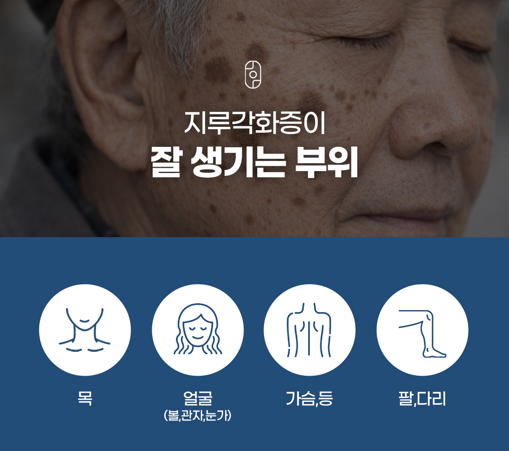 랜딩이미지