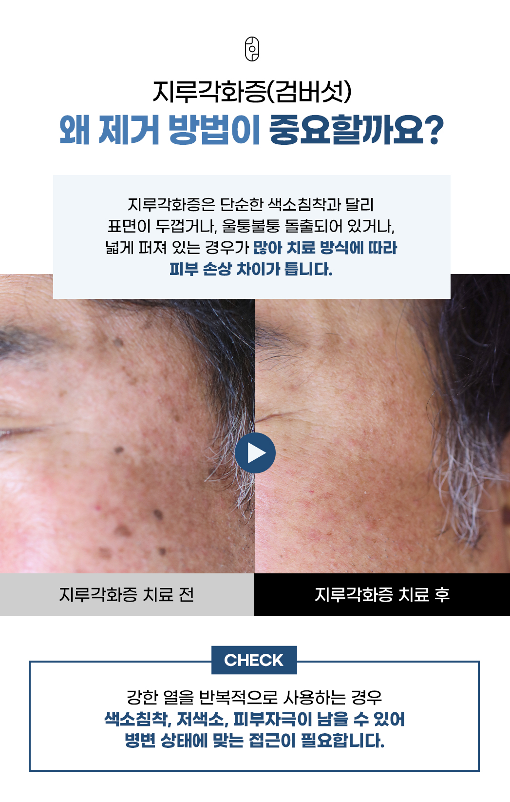 랜딩이미지