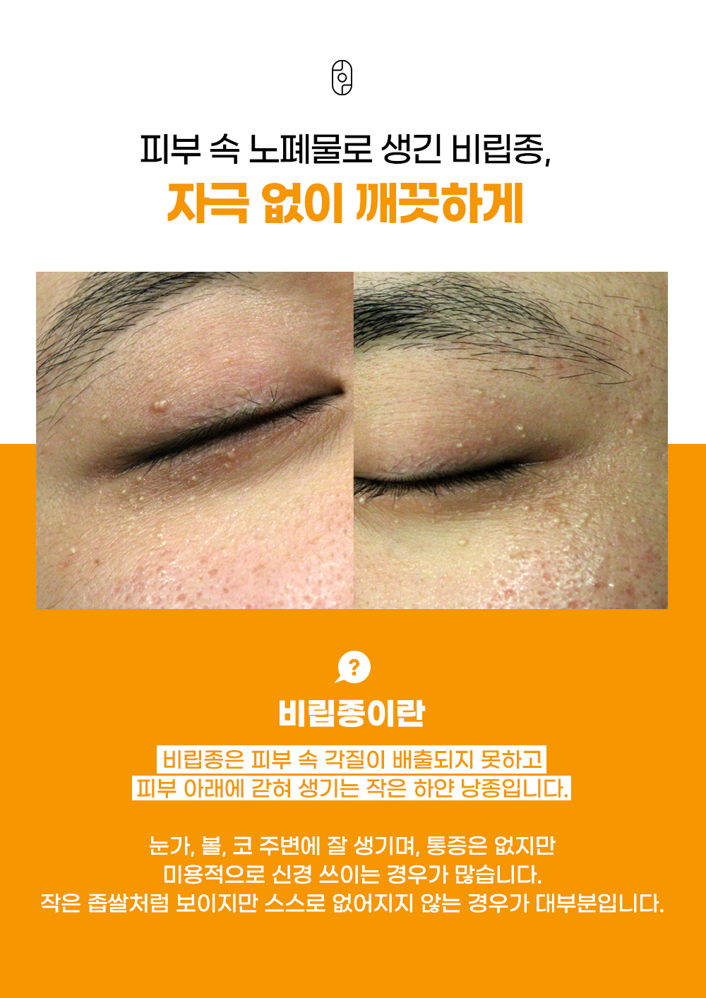 랜딩이미지