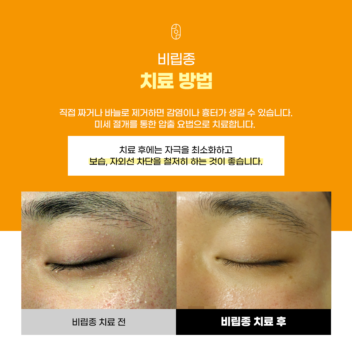 랜딩이미지