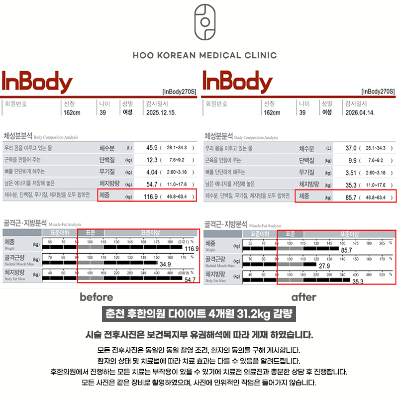 춘천다이어트한의원